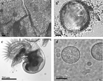 Statoliths from larval gastropods