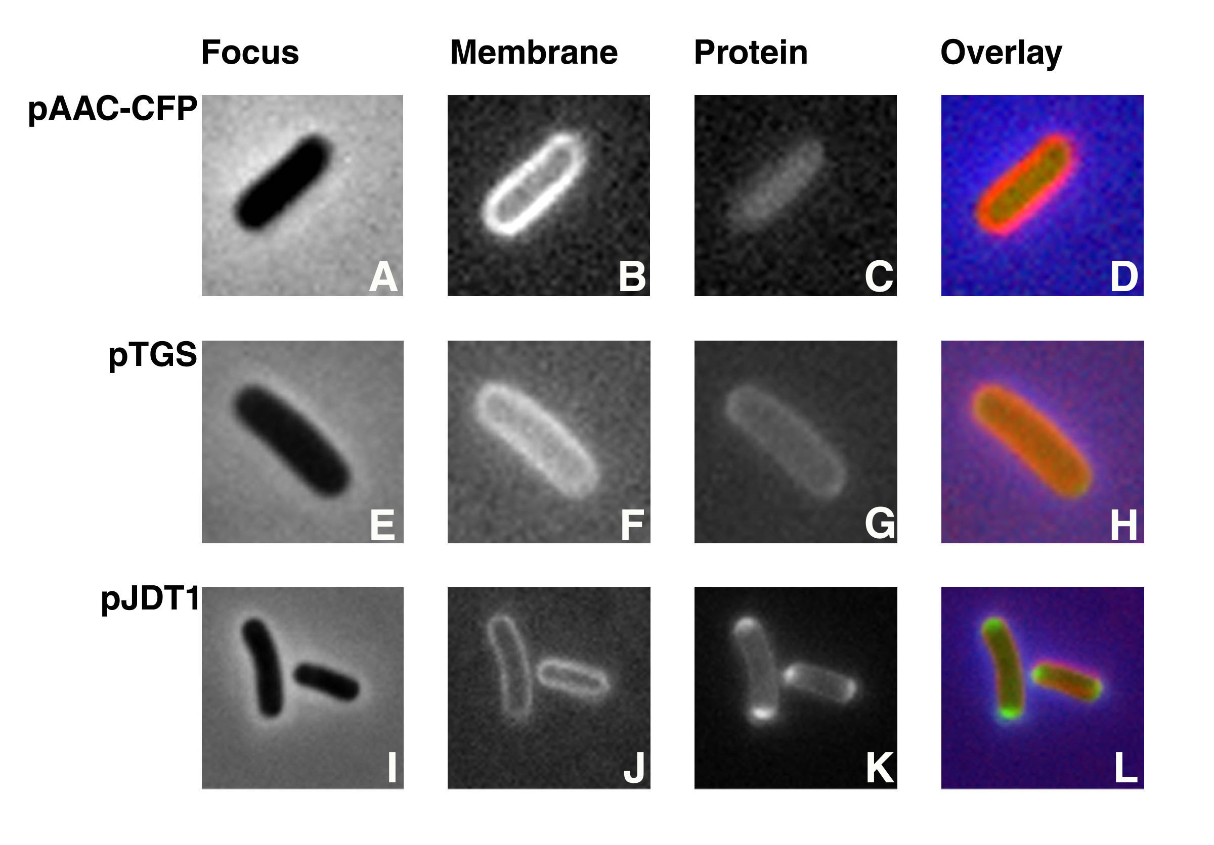 Visualization of protein fusions by fluorescence microscopy. Cells containing pAACCFP, pTGS, or pJDT1 treated as described (Dery et al. Antimicrob. Agents Chemother. 2003 47:2897-2902). Plasmids pTGS and pJDT1 were used as controls, they code for periplasmic proteins. However, Thomas et al. determined that the protein encoded by pJDT1 was located in the periplasmic space accumulating at the ends of the cell (Thomas et al. Mol. Microbiol. 2001 39:47-53). The membranes of all three strains were stained by incubation in 200 µg of FM5-95/ml at 37°C with shaking for 15 min. Cells were focused (A, E, and I) and examined using filter sets 31044v2 to detect CFP (C), 31019 to detect GFP (G and K), and 31058 to detect FM5-95 (B, F, and J). Overlays were generated by coloring the membranes red and the fusion proteins green (D, H, and L). AAC(6')-Ib is homogeneously distributed in the cell's cytoplasm. Figure taken from Dery et al. Antimicrob. Agents Chemother. 2003 47:2897-2902.
